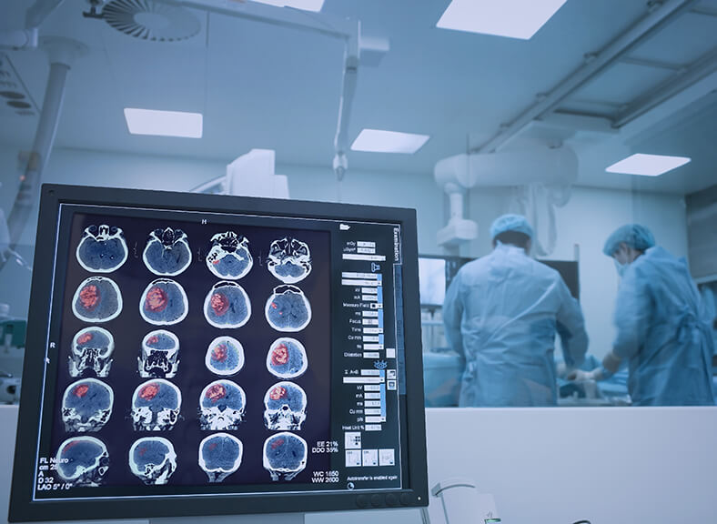 Neuroradiology